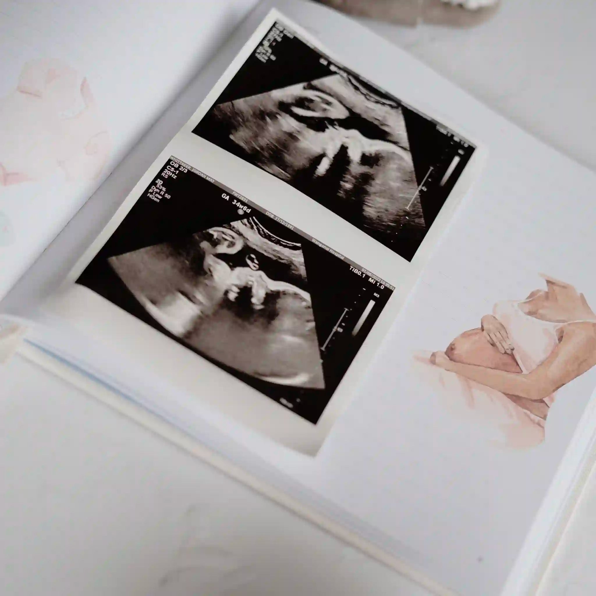 Ultrasound images of a baby in a white frame on a light surface